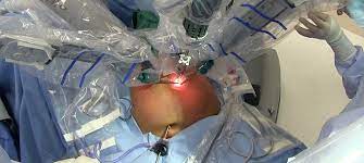 Robotic Surgery in treatment of Gynecological Cancers